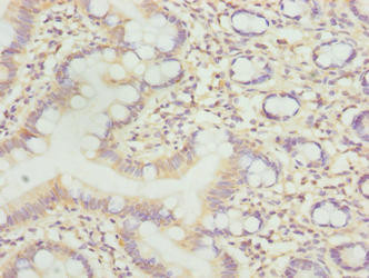 LLCFC1 Antibody in Immunohistochemistry (Paraffin) (IHC (P))