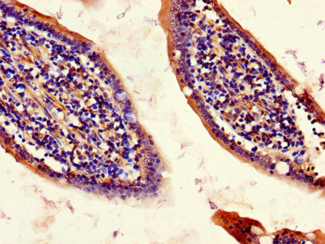 CISD2 Antibody in Immunohistochemistry (Paraffin) (IHC (P))