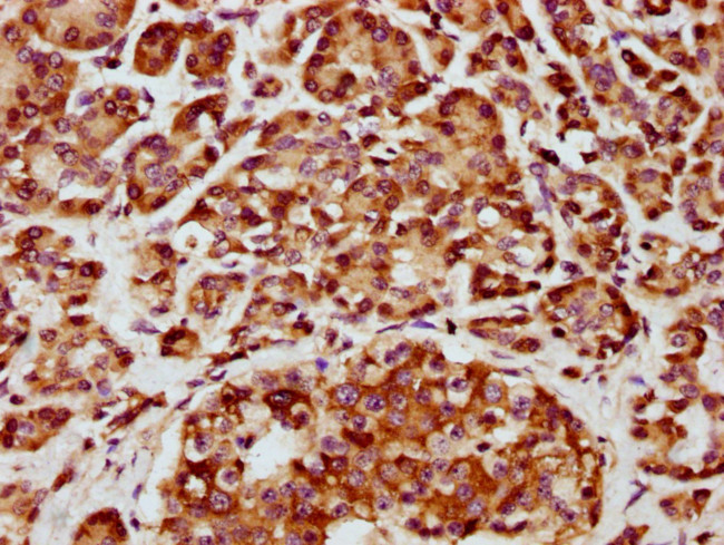 CHST14 Antibody in Immunohistochemistry (Paraffin) (IHC (P))