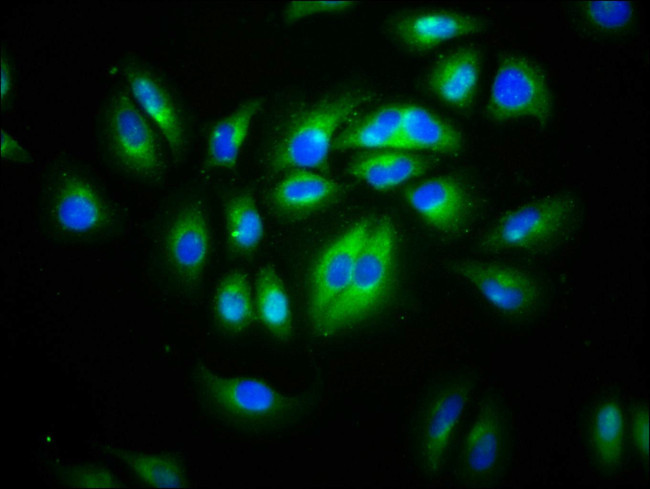 CD99L2 Antibody in Immunocytochemistry (ICC/IF)