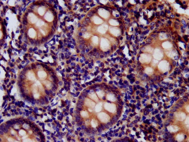 CD99L2 Antibody in Immunohistochemistry (Paraffin) (IHC (P))