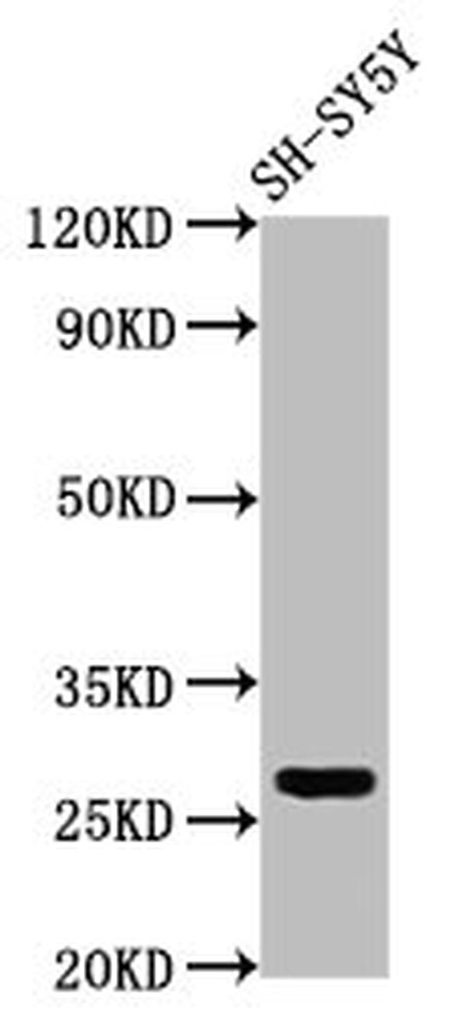 CD99L2 Antibody in Western Blot (WB)