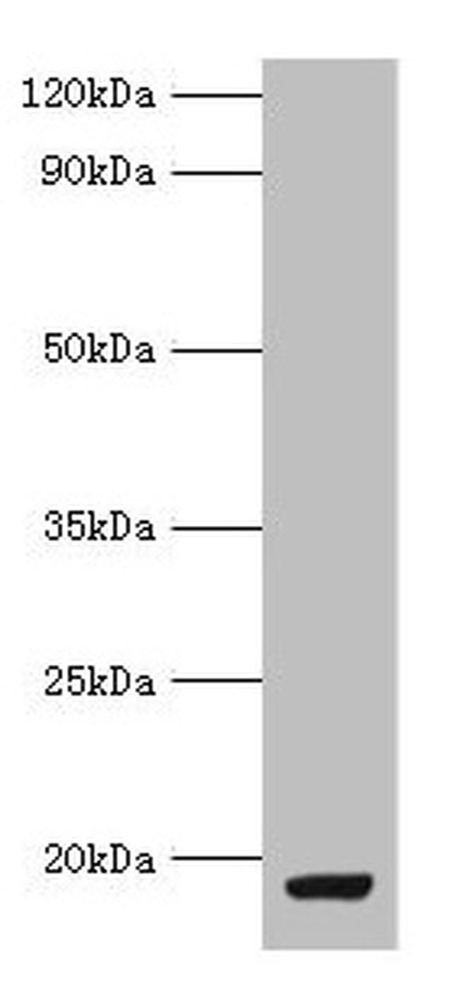 C19orf10 Antibody in Western Blot (WB)