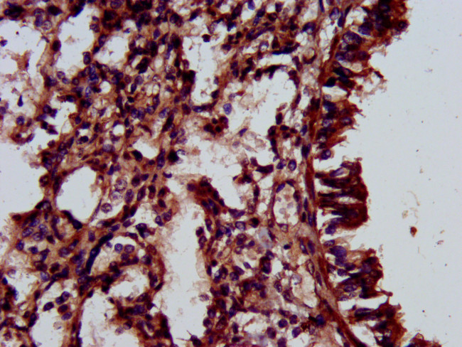 ELMOD3 Antibody in Immunohistochemistry (Paraffin) (IHC (P))