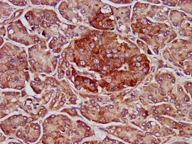 ELMOD3 Antibody in Immunohistochemistry (Paraffin) (IHC (P))