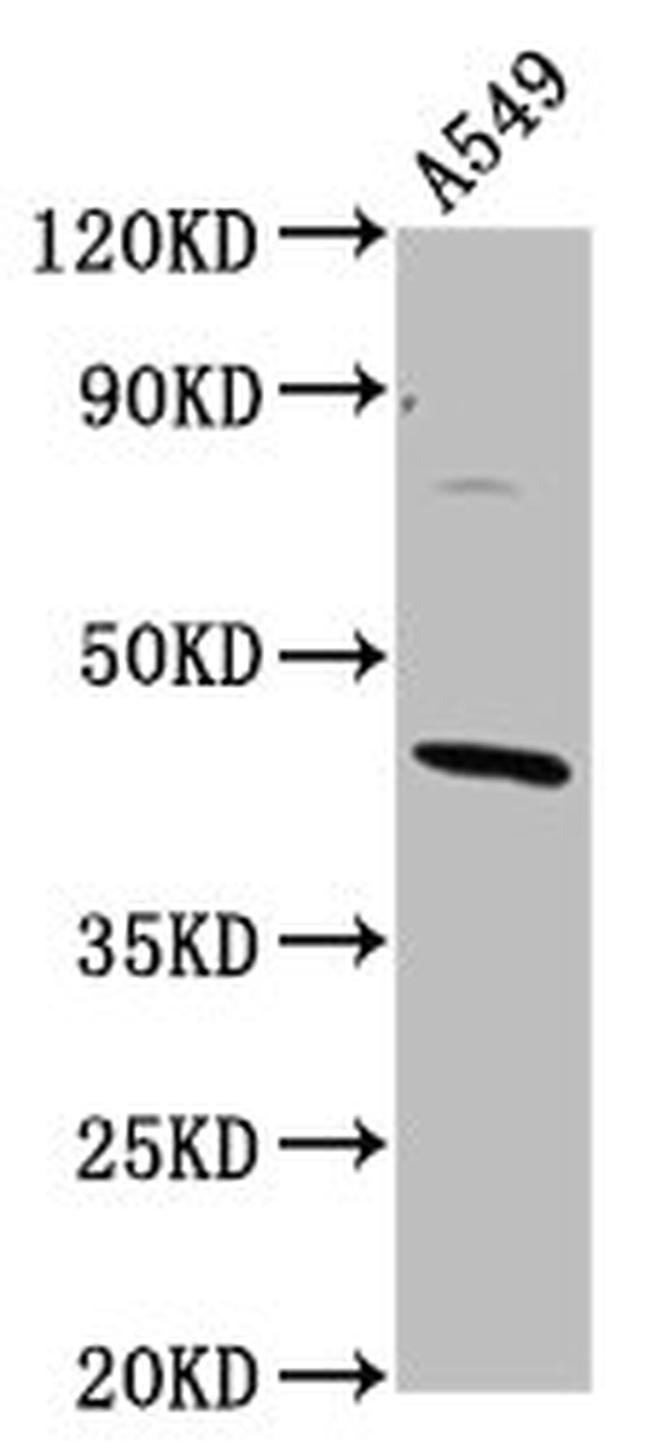 ELMOD3 Antibody in Western Blot (WB)