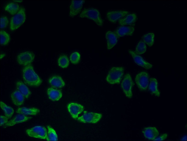 CATSPER2 Antibody in Immunocytochemistry (ICC/IF)