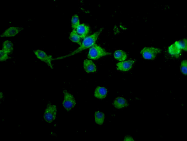 PCQAP Antibody in Immunocytochemistry (ICC/IF)