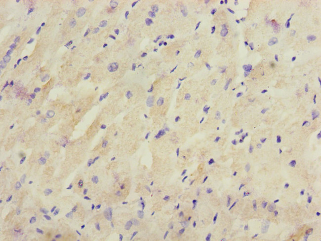 CRBN Antibody in Immunohistochemistry (Paraffin) (IHC (P))