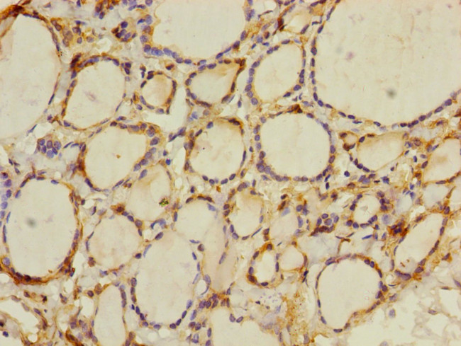 CRBN Antibody in Immunohistochemistry (Paraffin) (IHC (P))