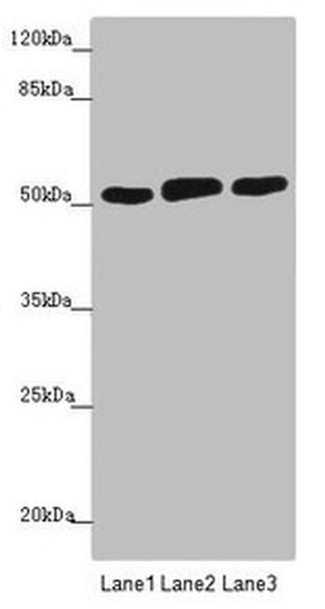 CRBN Antibody in Western Blot (WB)