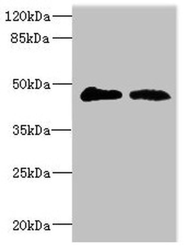 GCNT2 Antibody in Western Blot (WB)