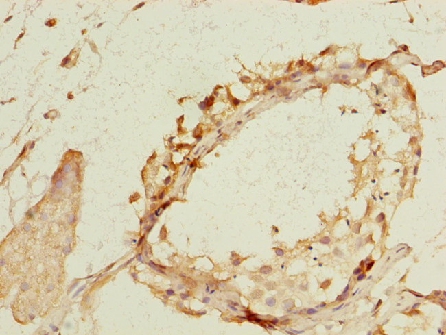 NEK11 Antibody in Immunohistochemistry (Paraffin) (IHC (P))