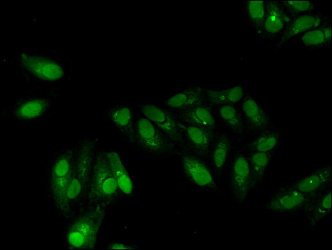 GABPB2 Antibody in Immunocytochemistry (ICC/IF)