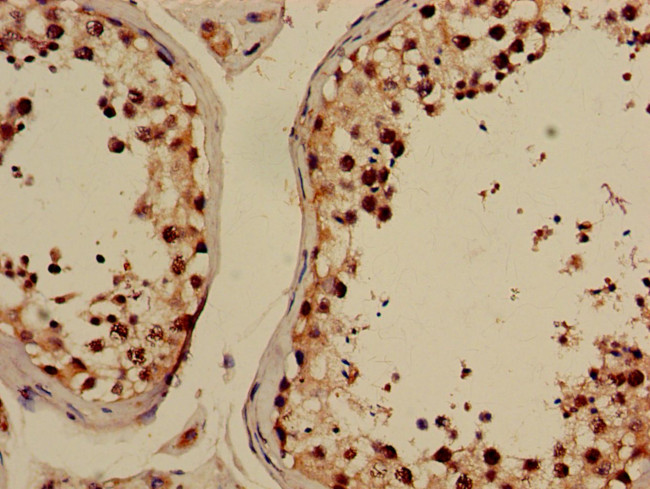 GABPB2 Antibody in Immunohistochemistry (Paraffin) (IHC (P))