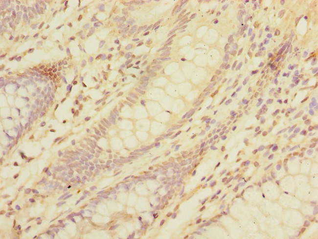 LMO3 Antibody in Immunohistochemistry (Paraffin) (IHC (P))