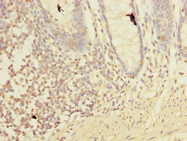 LMO3 Antibody in Immunohistochemistry (Paraffin) (IHC (P))