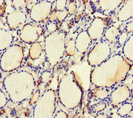 UBE2Q2 Antibody in Immunohistochemistry (Paraffin) (IHC (P))