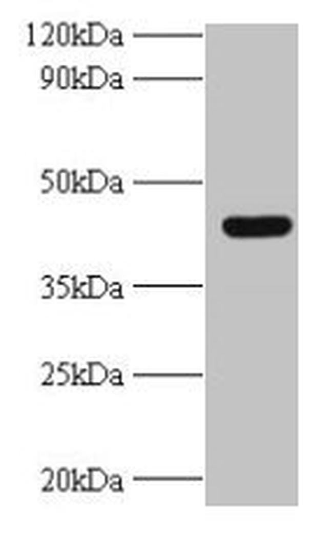 UBE2Q2 Antibody in Western Blot (WB)