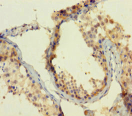 ATOH1 Antibody in Immunohistochemistry (Paraffin) (IHC (P))