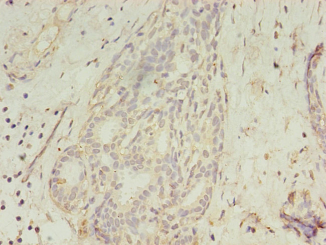 GCC1 Antibody in Immunohistochemistry (Paraffin) (IHC (P))