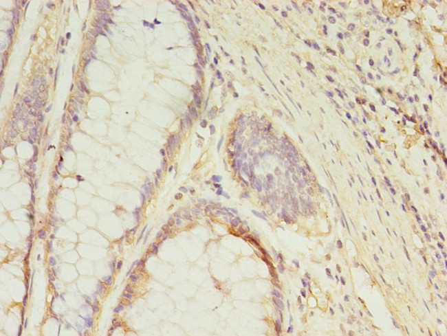 GCC1 Antibody in Immunohistochemistry (Paraffin) (IHC (P))