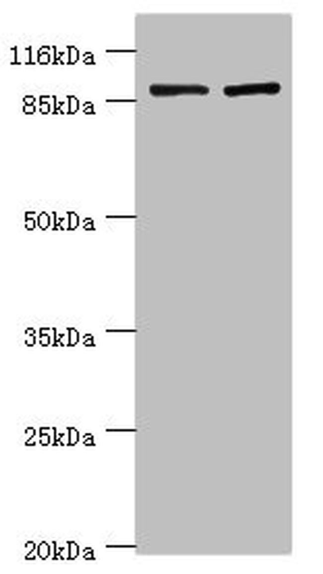 GCC1 Antibody in Western Blot (WB)