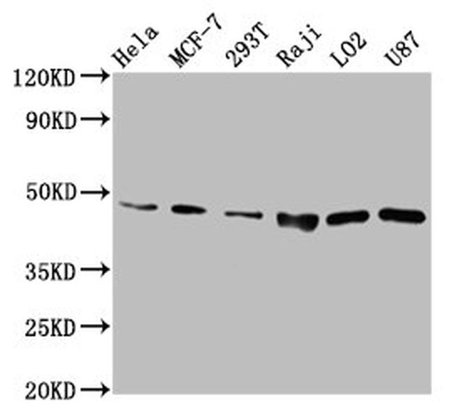 SUCLG2 Antibody in Western Blot (WB)