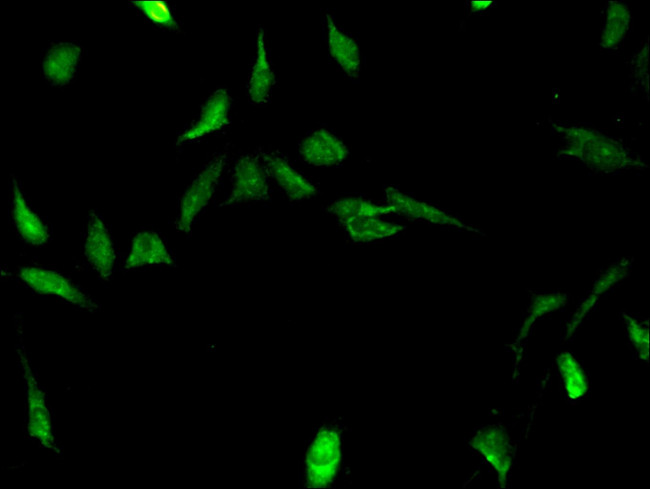 STRBP Antibody in Immunocytochemistry (ICC/IF)