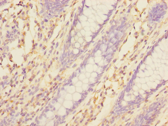 TXNDC5 Antibody in Immunohistochemistry (Paraffin) (IHC (P))