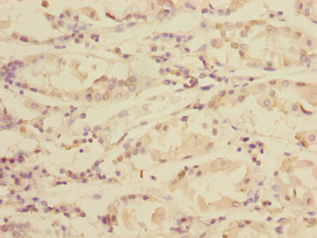 TXNDC5 Antibody in Immunohistochemistry (Paraffin) (IHC (P))