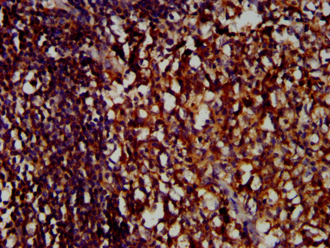 CD85j (ILT2) Antibody in Immunohistochemistry (Paraffin) (IHC (P))