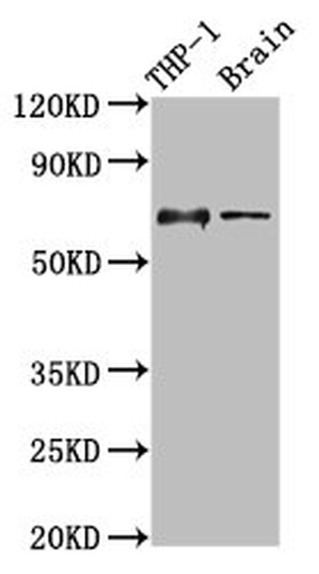 CD85j (ILT2) Antibody in Western Blot (WB)