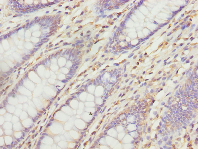 VANGL1 Antibody in Immunohistochemistry (Paraffin) (IHC (P))