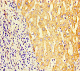 GCDH Antibody in Immunohistochemistry (Paraffin) (IHC (P))