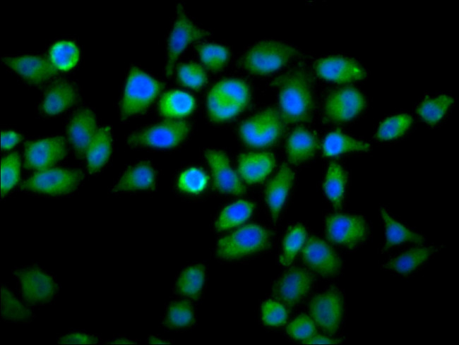 WDFY2 Antibody in Immunocytochemistry (ICC/IF)