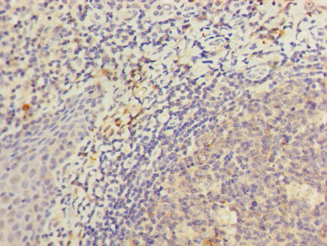 KIR3DL3 Antibody in Immunohistochemistry (Paraffin) (IHC (P))