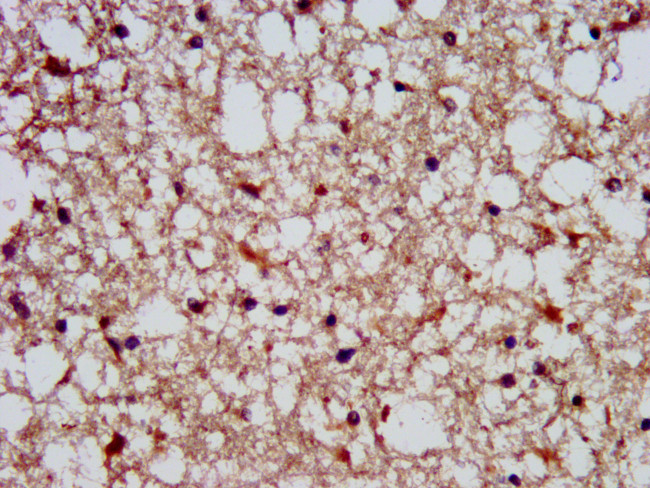 SLAIN1 Antibody in Immunohistochemistry (Paraffin) (IHC (P))