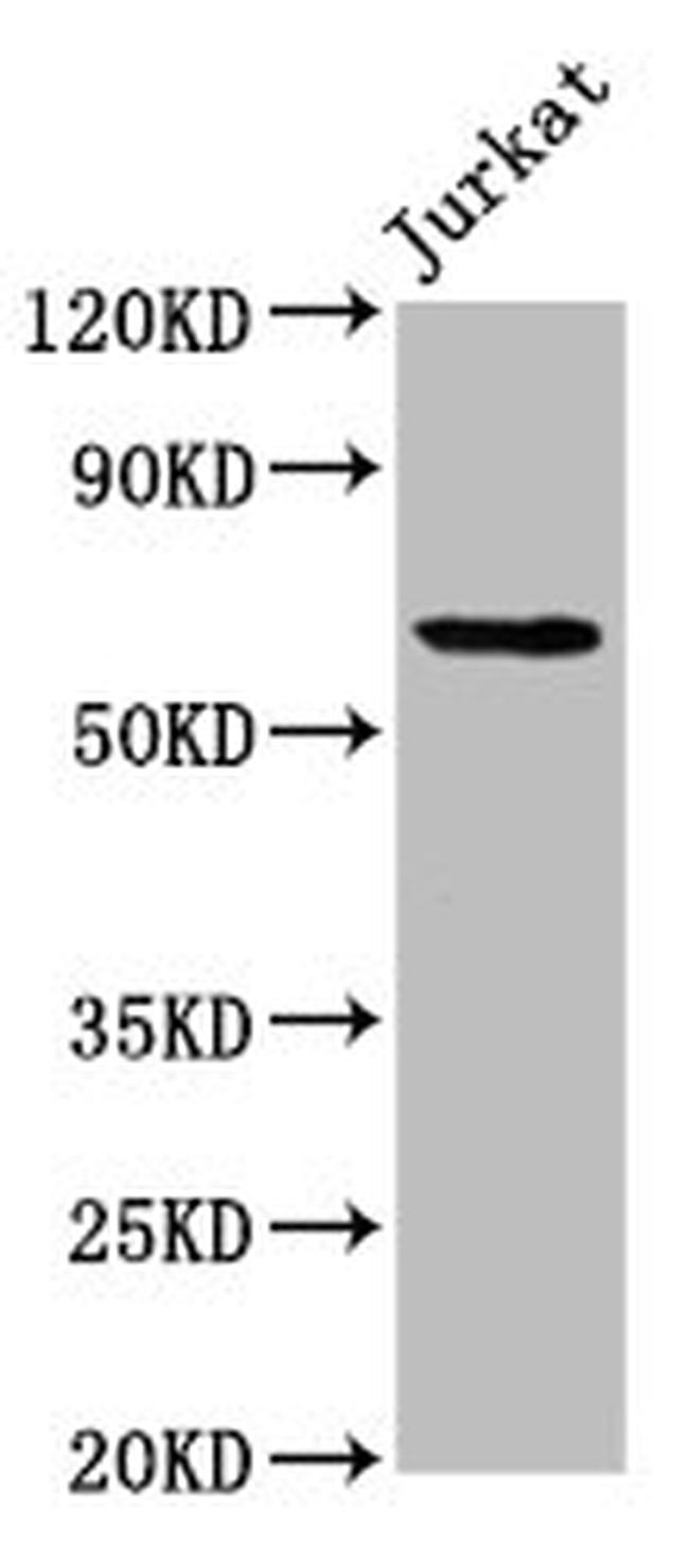 SLAIN1 Antibody in Western Blot (WB)