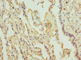 LILRB4 Antibody in Immunohistochemistry (Paraffin) (IHC (P))