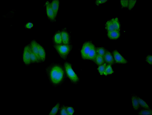 RABGGTA Antibody in Immunocytochemistry (ICC/IF)