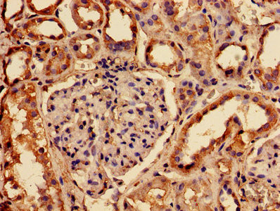 RABGGTA Antibody in Immunohistochemistry (Paraffin) (IHC (P))