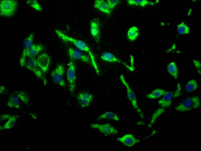 MR1 Antibody in Immunocytochemistry (ICC/IF)