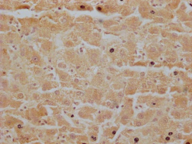 MR1 Antibody in Immunohistochemistry (Paraffin) (IHC (P))