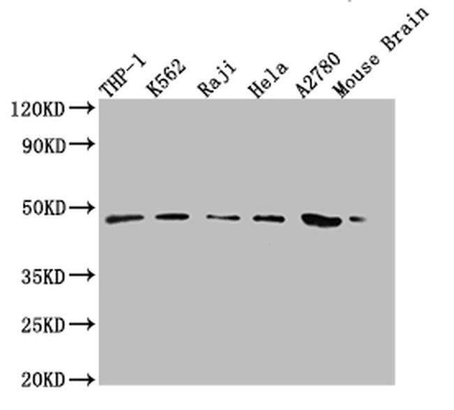 MR1 Antibody in Western Blot (WB)