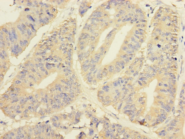 YME1L1 Antibody in Immunohistochemistry (Paraffin) (IHC (P))