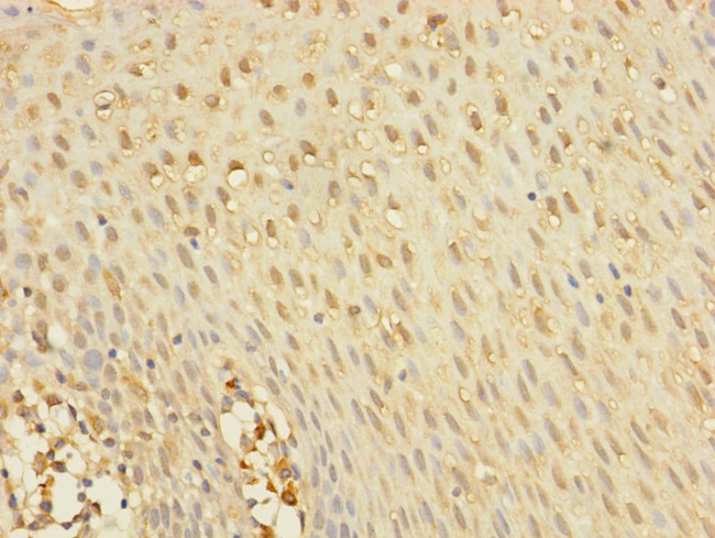 YME1L1 Antibody in Immunohistochemistry (Paraffin) (IHC (P))