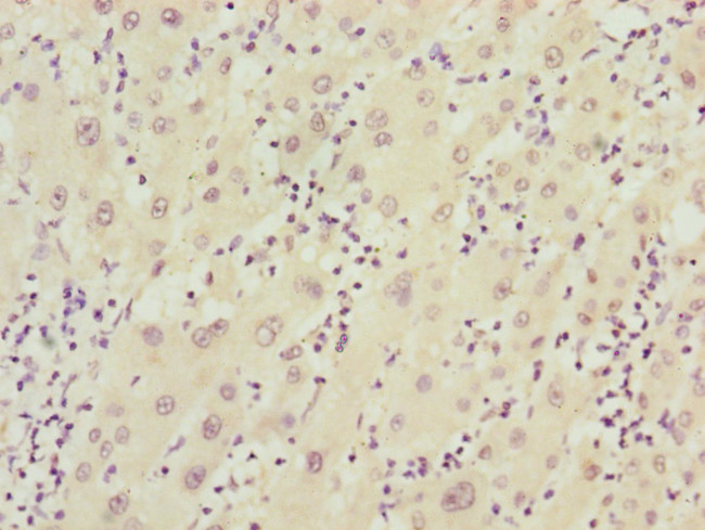 FBXO22 Antibody in Immunohistochemistry (Paraffin) (IHC (P))