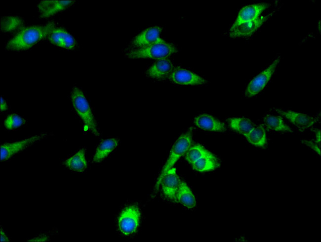 SPPL2A Antibody in Immunocytochemistry (ICC/IF)