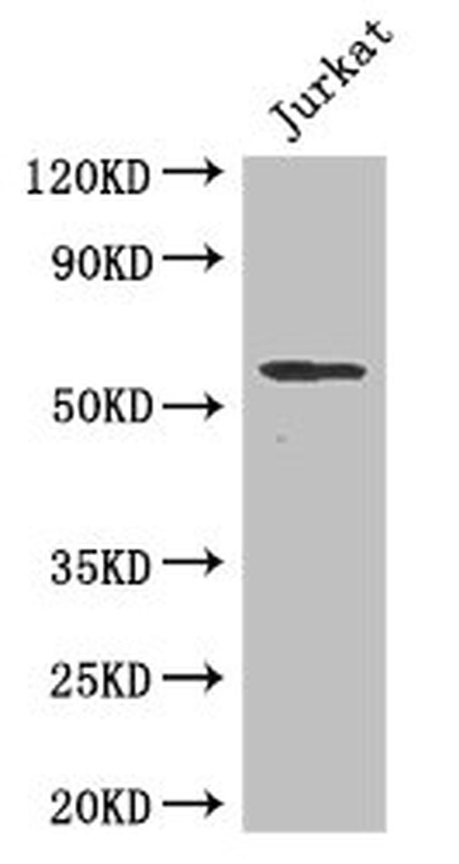 SPPL2A Antibody in Western Blot (WB)